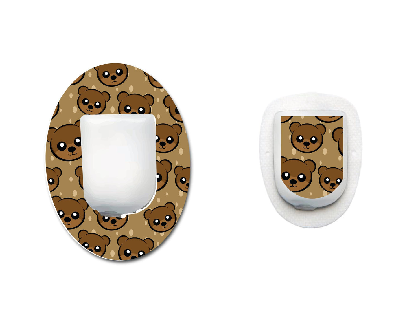 Frog Set CGM
